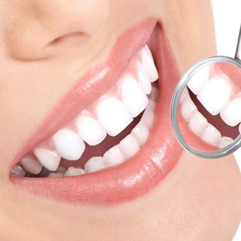 Smilezeit Teeth Whitening Strips
